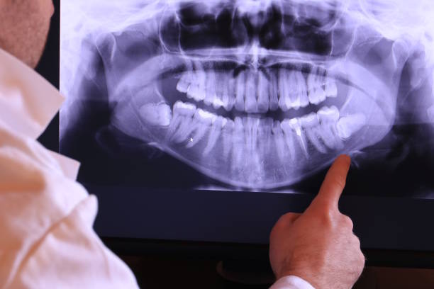 Best Emergency TMJ Treatment in Olyphant, PA