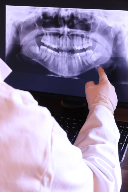 Best Urgent Care for Lost Fillings or Crowns in Olyphant, PA